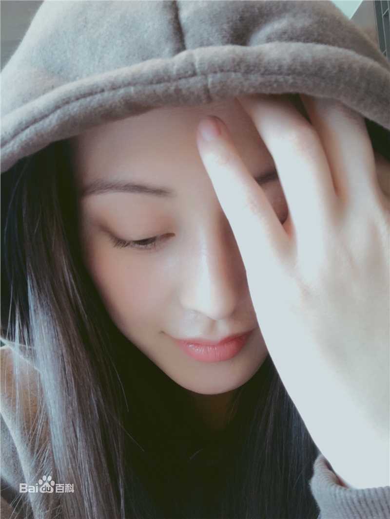 王力可(Rainbow)前后照片