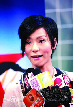 滕丽名(Joyce Tang)前后照片