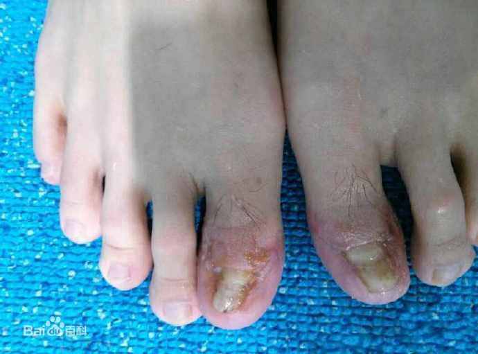 孙杨(Sun Yang)受伤性感图片图集