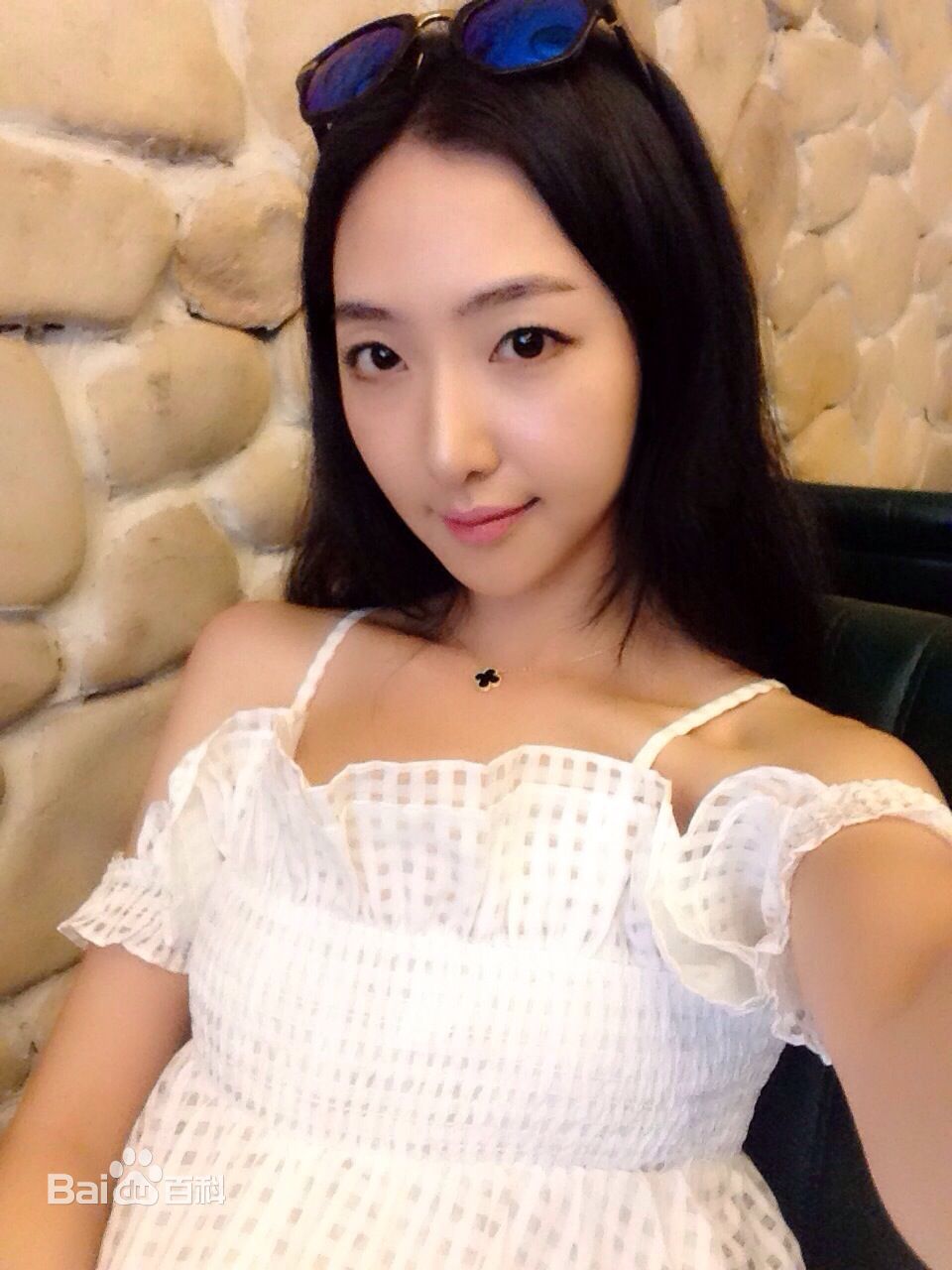 徐铭悦(Xu mingyue)前后照片