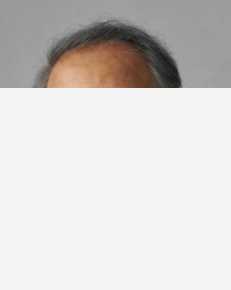 岸部一德(Ittoku Kishibe)前后照片