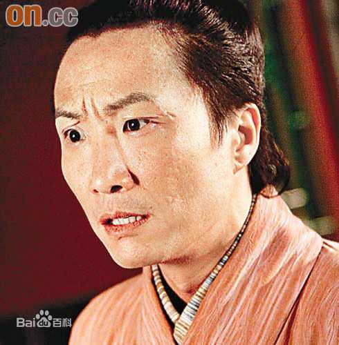 郑中基(Ronald Cheng)前后照片