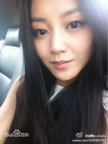 卫诗雅(Michelle)前后照片