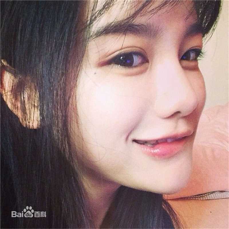 罗小伊(Royi)生活之乐前后照片