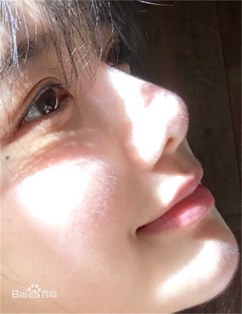 罗小伊(Royi)生活之乐前后照片