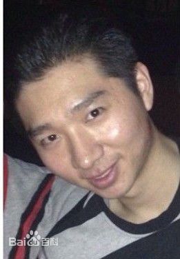 陈佩斯(Peisi Chen)先生前后照片