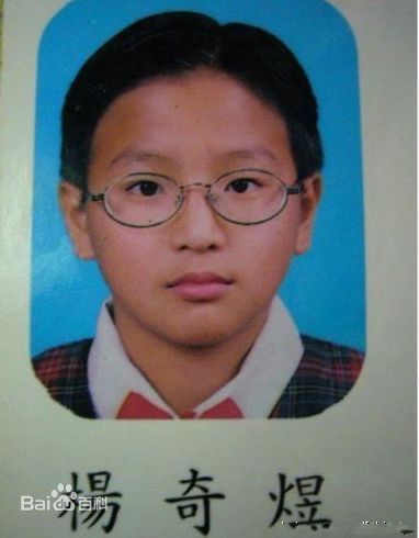 杨奇煜(Fabien)前后照片