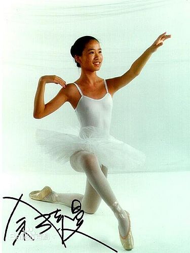 佘诗曼(Charmaine Sheh)童年照前后照片