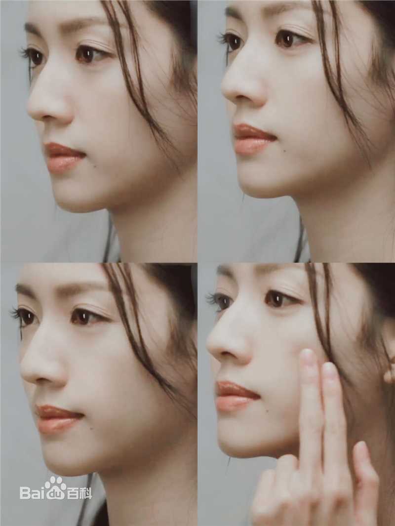 蔡思贝(Sisley Choi)前后照片