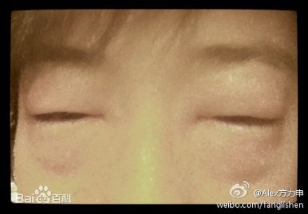 高清方力申(Alex Fong)精彩图册