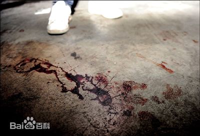 鄢颇遇袭素颜照相册