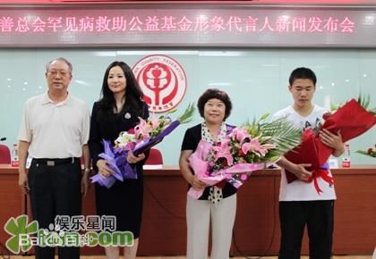 咏梅积极参与公益慈善事业素颜照相册