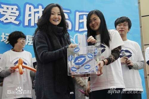 咏梅积极参与公益慈善事业素颜照相册