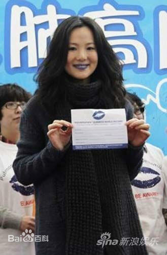 咏梅积极参与公益慈善事业素颜照相册