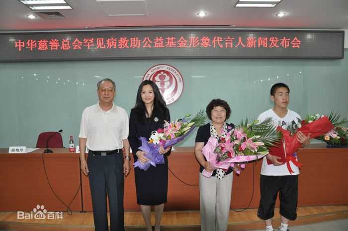 咏梅积极参与公益慈善事业素颜照相册