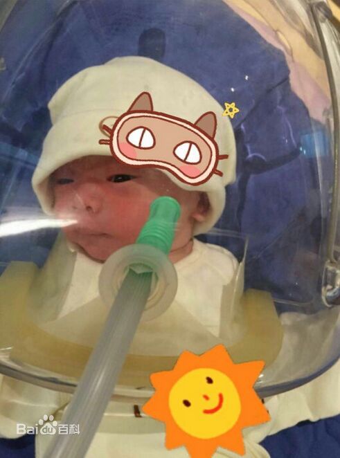 张龄心前后照片