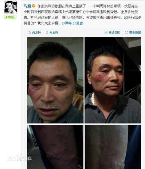 马原遭殴打前后照片