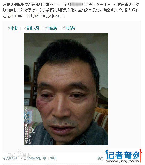 马原遭殴打前后照片