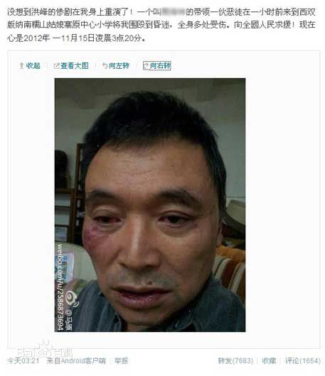 马原遭殴打前后照片