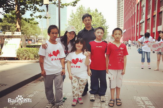 练练“瓷娃娃”公益活动素颜照相册