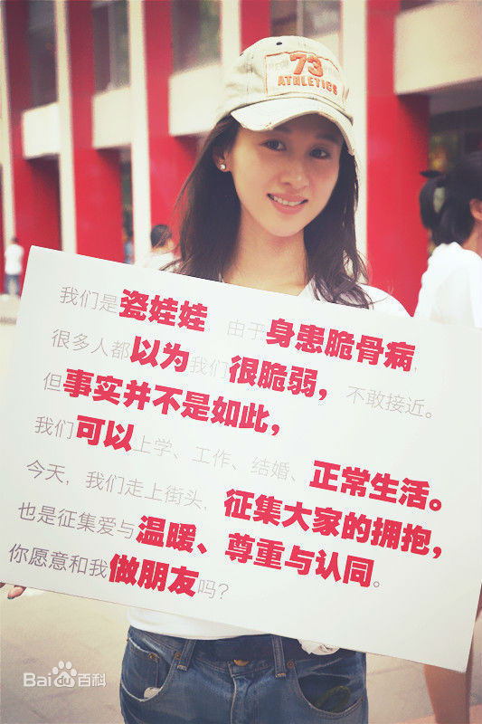 练练“瓷娃娃”公益活动素颜照相册