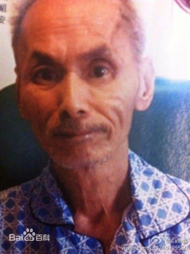 刘家辉(Gordon Liu)中风瘫痪壁纸壁纸