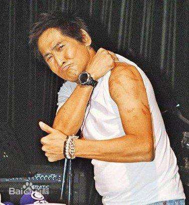 齐秦(Chyi Chin)意外烧伤图片图集