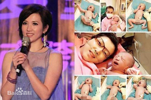 廖家仪(Kelly)前后照片