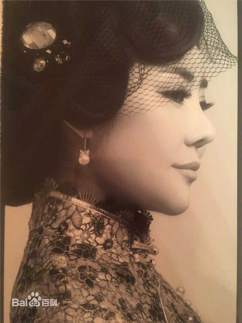 孟江南(Nancy)前后照片