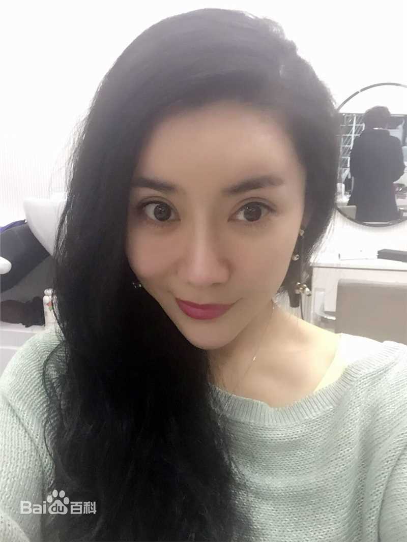 孟江南(Nancy)前后照片