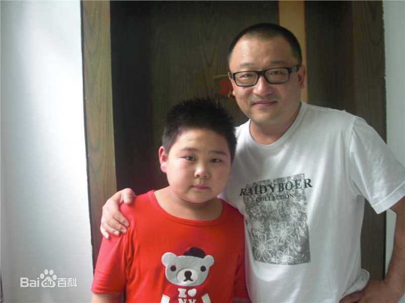 张珂源(Tom)活动照前后照片