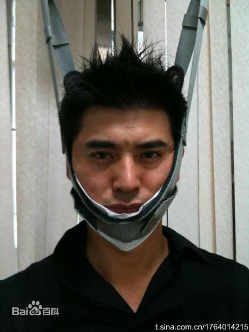 邵昕生活照片前后照片