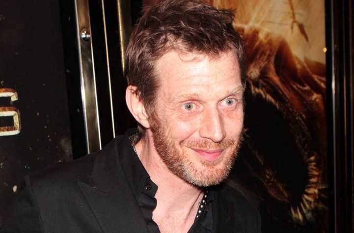 杰森·弗莱明(Jason Flemyng)前后照片