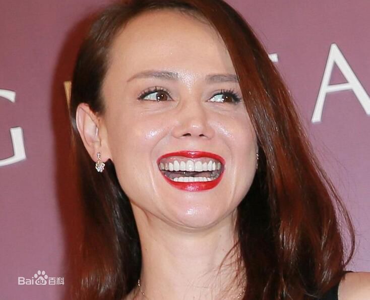 韩君婷(Belinda Hamnett)前后照片