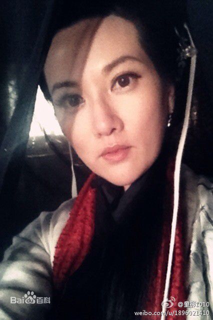 童彤(Terrna)童荣庆前后照片