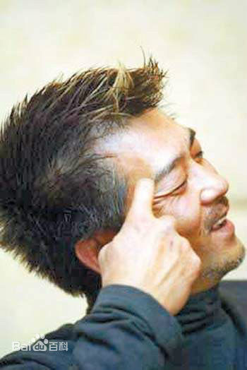 林迪安(Dion Lam)照片图片图册