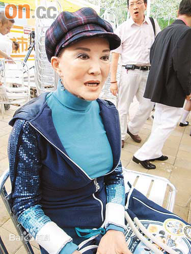 白韵琴(Pamela Pak Wan-Kam)前后照片