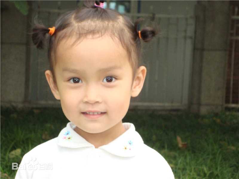 高俊(Clory)前后照片