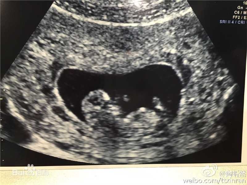 何建泽何陶妈的孕育照片性感图片图集