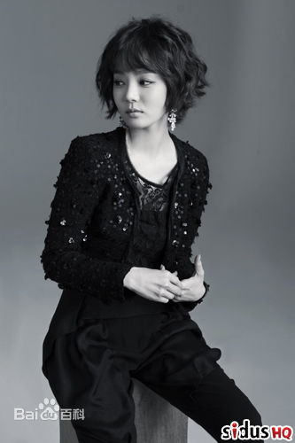 蔡琳()前后照片