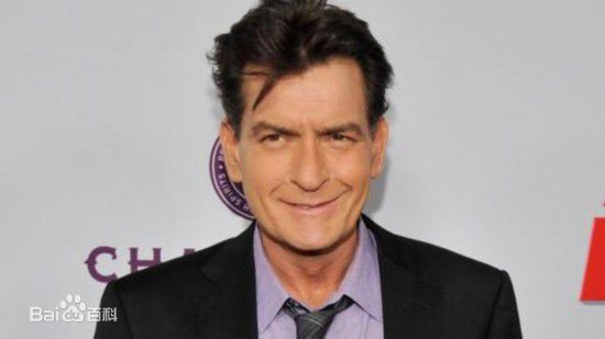 查理·辛(Charlie Sheen)前后照片