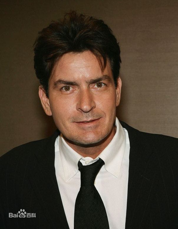 查理·辛(Charlie Sheen)前后照片