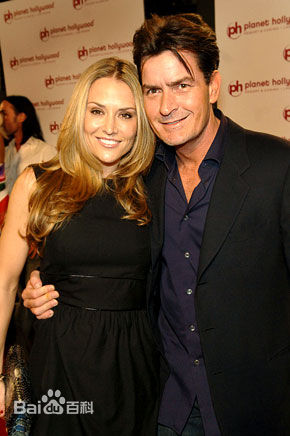 查理·辛(Charlie Sheen)前后照片