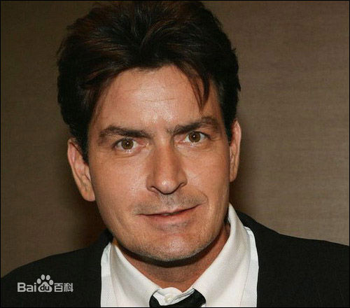 查理·辛(Charlie Sheen)前后照片