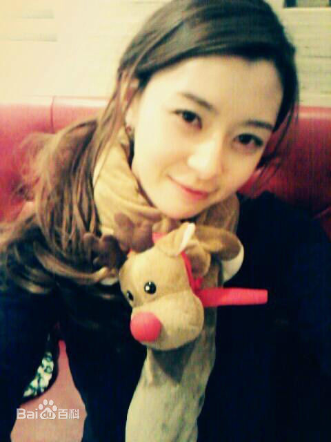 权娜拉(Kwon NaRa)前后照片