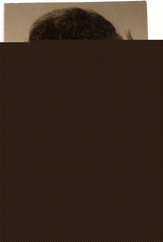 邓碧云前后照片