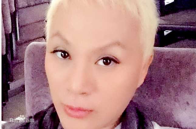 吉米(Jimmy)前后照片