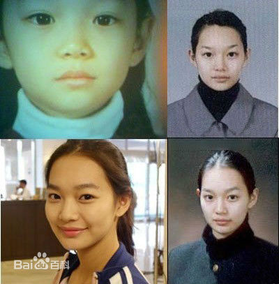 申敏儿(Shin Min A)前后照片
