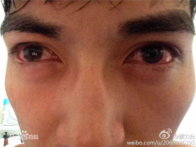 蔡力允前后照片