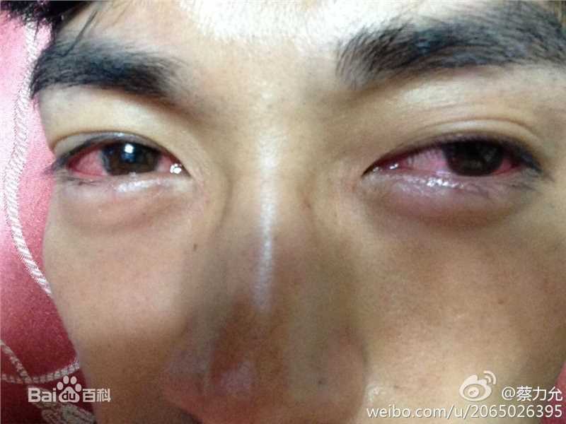 蔡力允前后照片